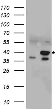 Polyclonal Rabbit anti-Human NTHL1 Antibody (WB)