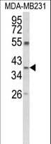 ARG1 / Arginase 1 Antibody (aa293-322)