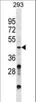 VSX2 / CHX10 Antibody (aa263-291)
