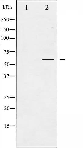 MAP3K8 / TPL2 Antibody
