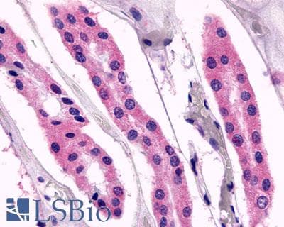 IHC-plus™ Polyclonal Rabbit anti-Human ADGRV1 / GPR98 Antibody (N-Terminus, IHC, WB)