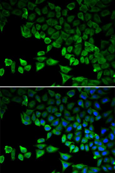 Polyclonal Rabbit anti-Human DDX58 / RIG-1 / RIG-I Antibody (IHC, IF, WB)
