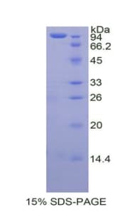 Human TGM2 / Transglutaminase 2 Protein (Recombinant His, N-Terminal)