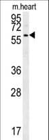 Polyclonal Rabbit anti-Human PRELP / Prolargin Antibody (aa119-148, IHC, WB)