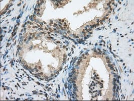 Monoclonal Mouse anti-Human ACSBG1 / hsBG Antibody (clone OTI1D8, IHC, IF, WB)