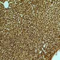 PIK3R1 / p85 Alpha Antibody