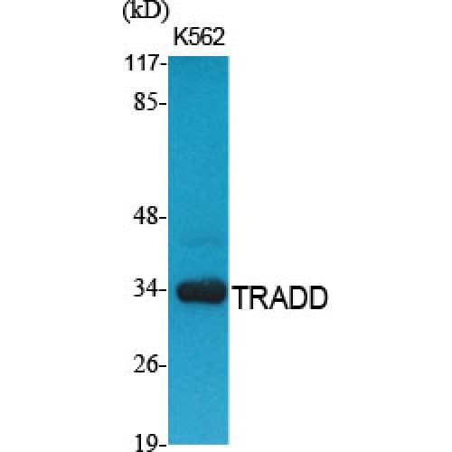 TRADD Antibody (220-300 aa, C-terminal)