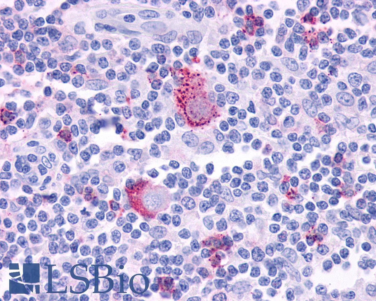 PathPlus™ FPR2 / FPRL1 Antibody (C-Terminus)