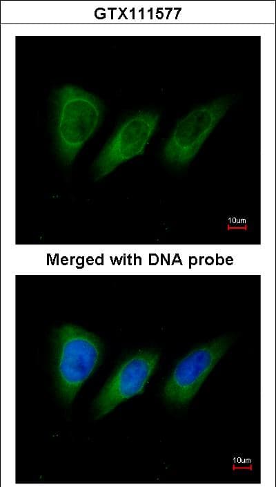 PKN2 Antibody (aa46-366)