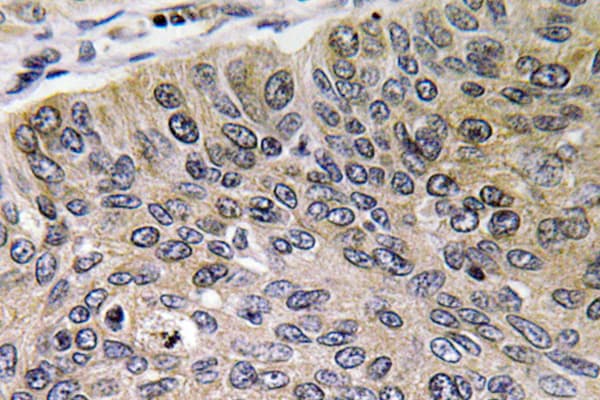 Polyclonal Rabbit anti-Human CTSE / Cathepsin E Antibody (aa243-292, IHC, WB)