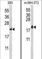 Polyclonal Rabbit anti-Human RPL18A Antibody (aa140-166, IHC, WB)