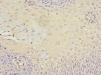 Polyclonal Rabbit anti-Human MCM10 Antibody (IHC)