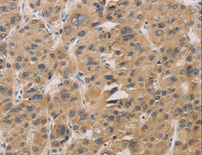 DDIT4 / REDD1 Antibody
