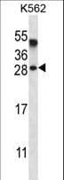 Polyclonal Rabbit anti-Human AMELX Antibody (aa17-46, IHC, WB)