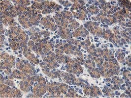 Monoclonal Mouse anti-Human GPR49 / LGR5 Antibody (clone OTI2H7, aa250-550, IHC, IF, WB)