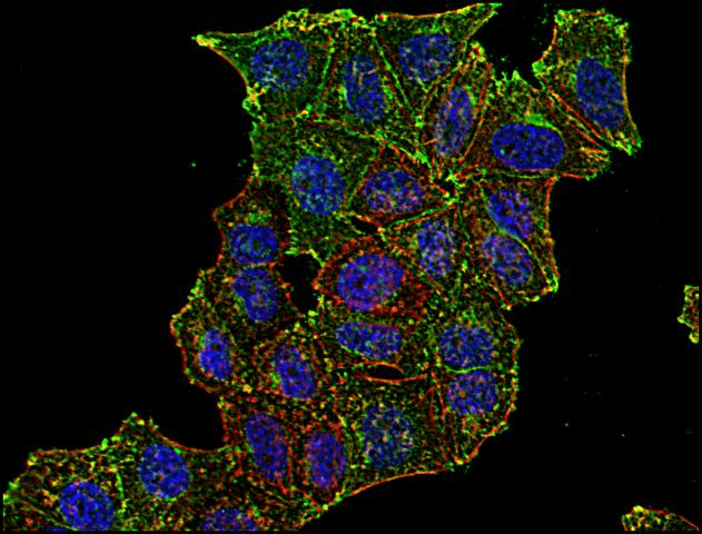 CD71 / Transferrin Receptor Antibody (clone MEM-75)