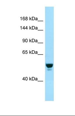RABGAP1 Antibody (aa96-145)