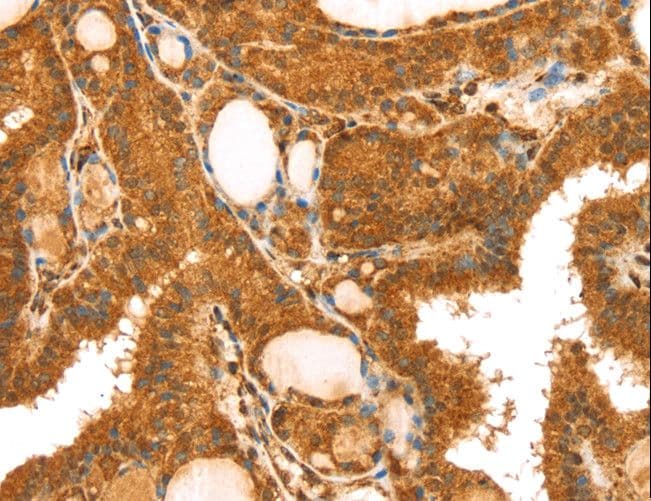 TRIM25 Antibody