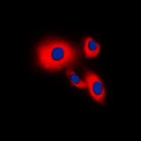 CDC25B Antibody (Internal)