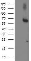Monoclonal Mouse anti-Human ACSM5 / MACS3 Antibody (clone OTI5D5, WB)