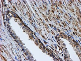 PSMB9 Antibody (aa21-219, clone OTI1D1)