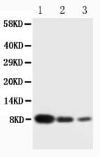 CXCL4 / PF4 Antibody (aa85-101)