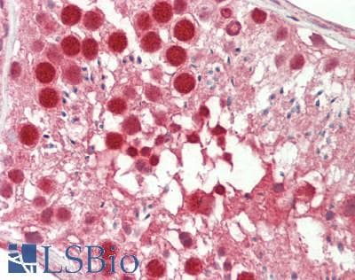 IHC-plus™ Polyclonal Rabbit anti-Human ZMYM2 / RAMP Antibody (aa1327-1377, IHC, WB)