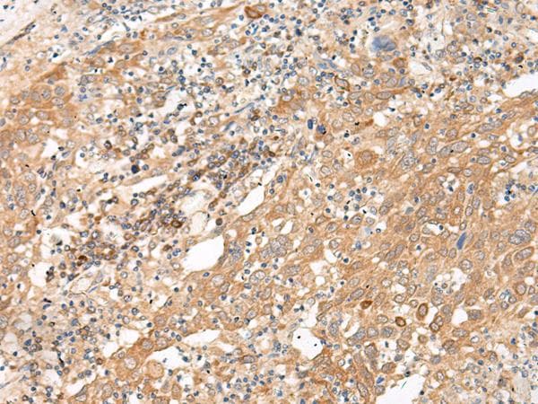 GALP / Alarin Antibody