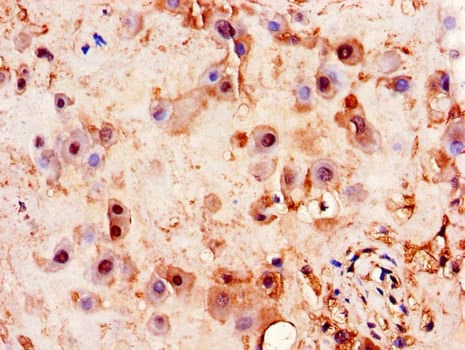 Polyclonal Rabbit anti-Human PITX3 Antibody (IHC, WB)