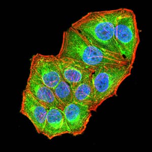 NAA10 / ARD1A Antibody (clone 3G3B9)