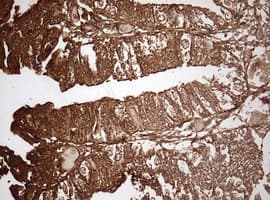 Monoclonal Mouse anti-Human GAPDH Antibody (clone OTI2F9, IHC, WB)