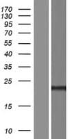 Human TMEM240 / C1orf70 Protein (Over-Expression Lysate Myc-DDK (Flag))