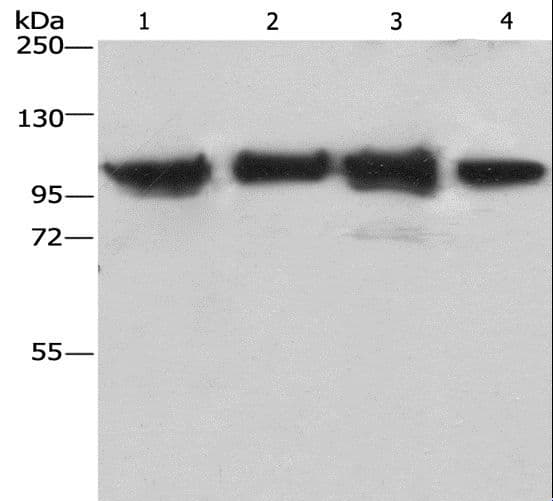 ACTN4 Antibody