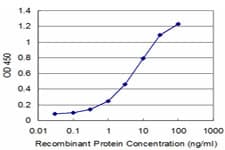 IHC-plus™ NEK2 Antibody (clone 2F6)