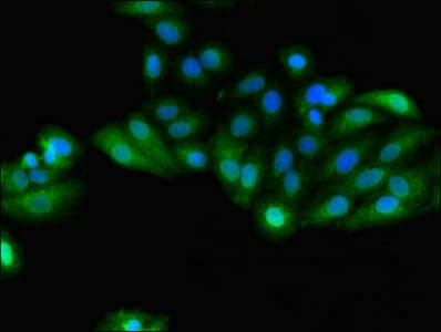 GSTA4 Antibody (aa1-222)