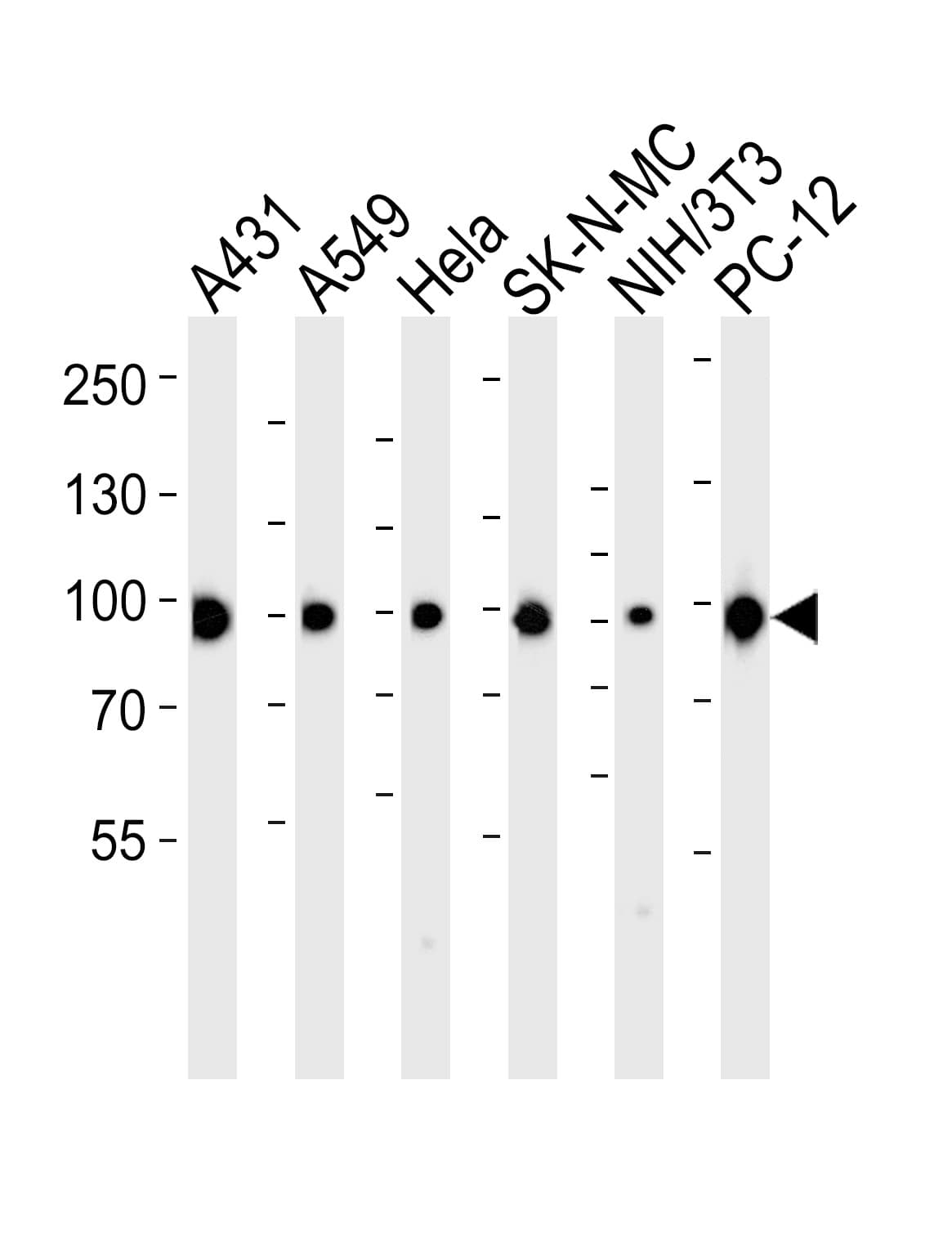 HSP90AA1 / Hsp90 Alpha A1 Antibody (aa644-677)