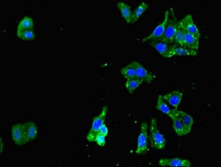 RENT1 / UPF1 Antibody