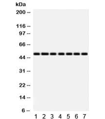 Polyclonal Rabbit anti-Human IDH2 Antibody (IHC, WB)