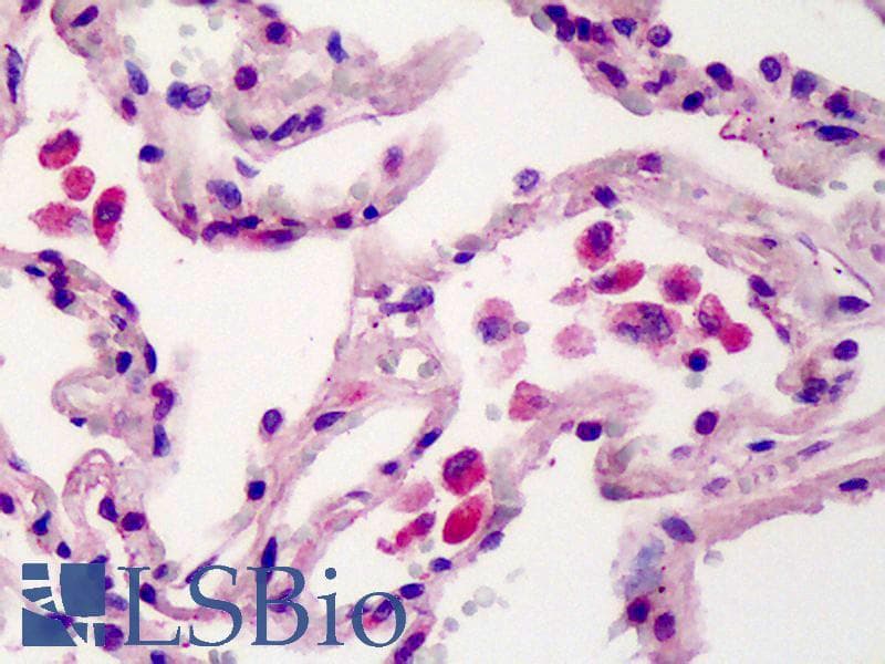 IHC-plus™ Polyclonal Rabbit anti-Human TMEM123 / Porimin Antibody (aa173-188, IHC, WB)