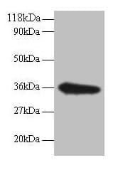 Polyclonal Rabbit anti-Human TSTA3 / GDP-L-Fucose Synthase Antibody (IHC, WB)