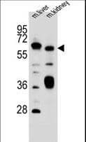 IHC-plus™ SLC2A13 / HMIT / GLUT13 Antibody (aa268-297)