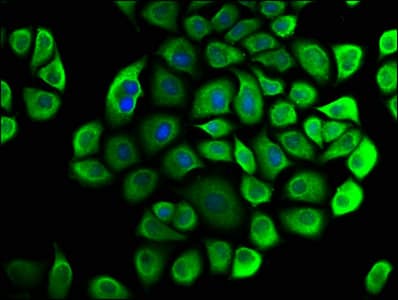 Polyclonal Rabbit anti-Human CNOT3 Antibody (IHC)