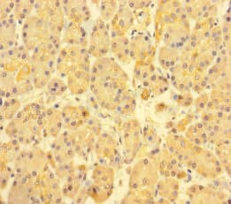 TARSH / ABI3BP Antibody