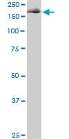 EIF4G1 / EIF4G Antibody (clone 3A10)