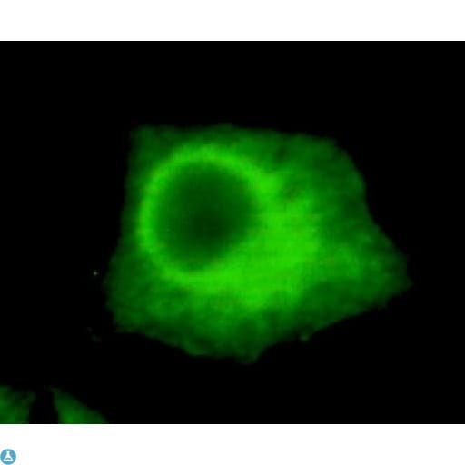 UHRF1 Antibody