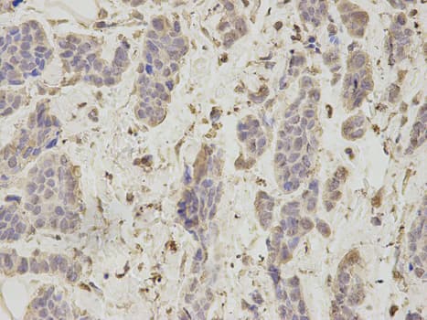 IHC-plus™ Polyclonal Rabbit anti-Human PSMA1 Antibody (IHC, IF, WB)