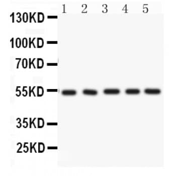 ARSA / Arylsulfatase A Antibody (aa454-482)