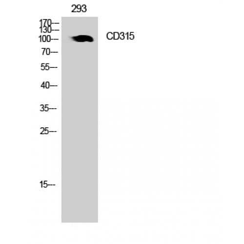 PTGFRN Antibody (601-650 aa, Internal)