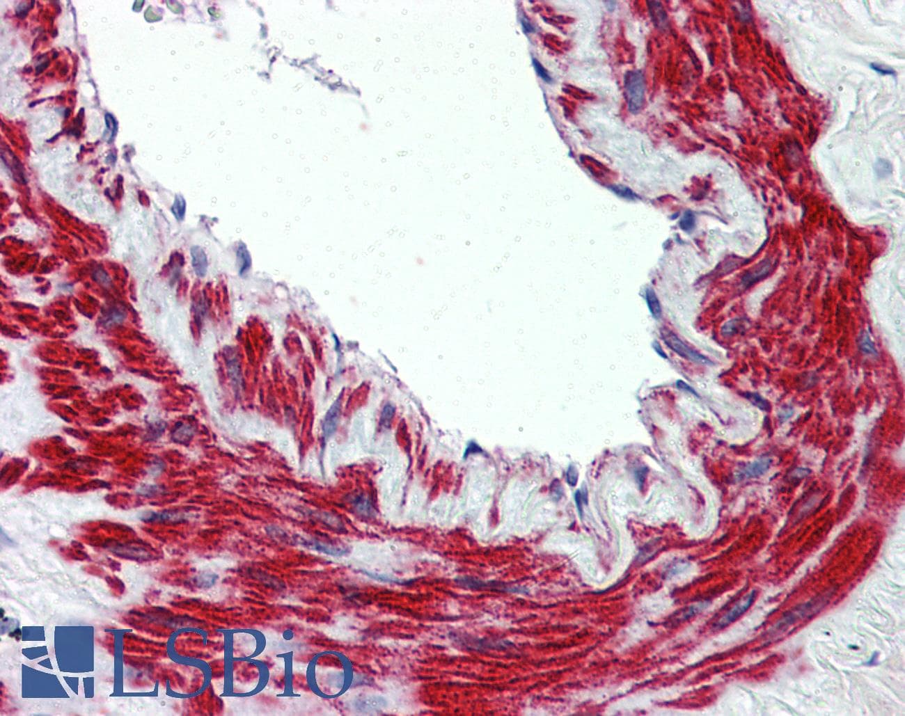 PathPlus™ TRPM8 Antibody (N-Terminus)