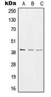 Polyclonal Rabbit anti-Human RTCD1 / RPC Antibody (C-Terminus, IHC, WB)